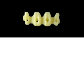 Cod.E21 f Upper Anterior: 10x  hollow pontics blocks-frames, (12-22), carved to fit into wax veneers Cod.E21Upper Anterior, SMALL, not arched, (12-22), for porcelain pressed to metal bridgework